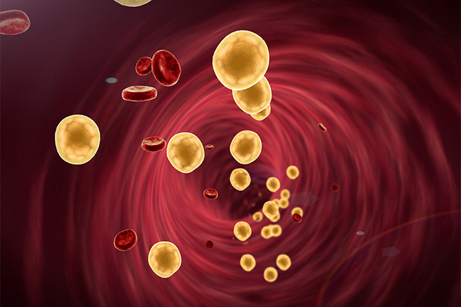 high cholesterol blood vessel