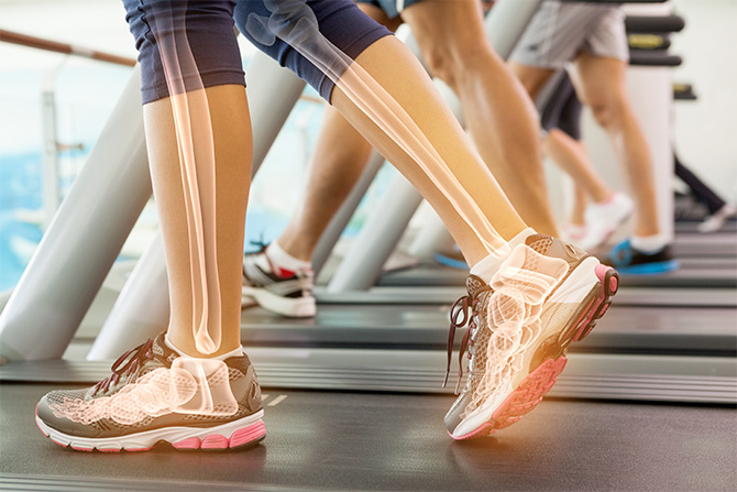 fitness treadmill bone health