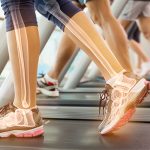 fitness treadmill bone health
